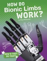 How_do_bionic_limbs_work_
